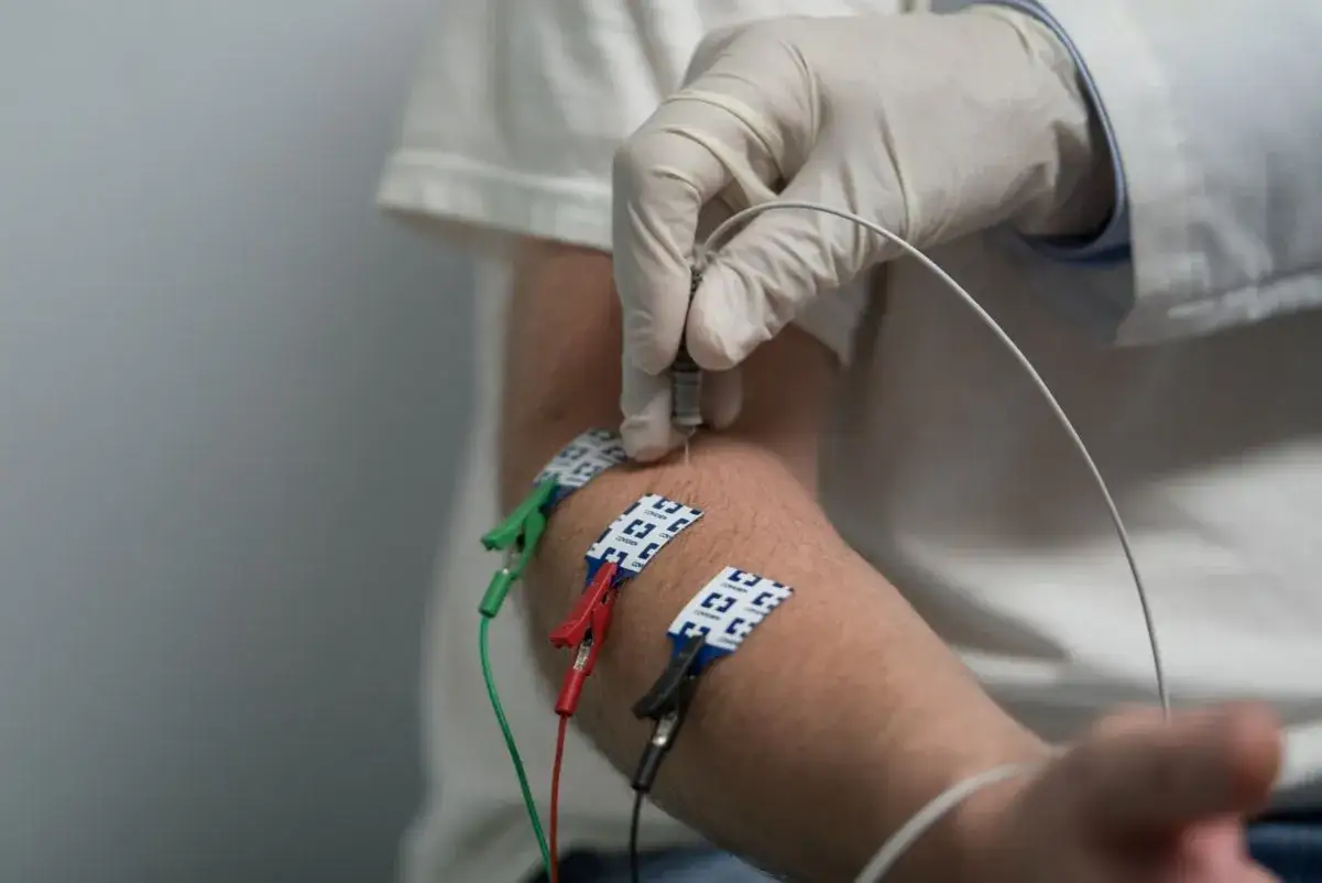 Lekarz od nerwów wykonuje badanie EMG, wprowadzając igłę do ramienia pacjenta. Elektrody są przyczepione do skóry.