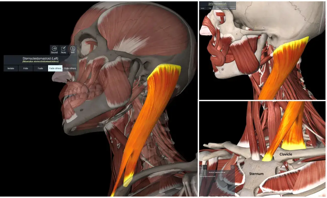 Anatomie du muscle sterno-cl&eacute;ido-masto&iuml;dien. Visualisation pour le traitement de la douleur.