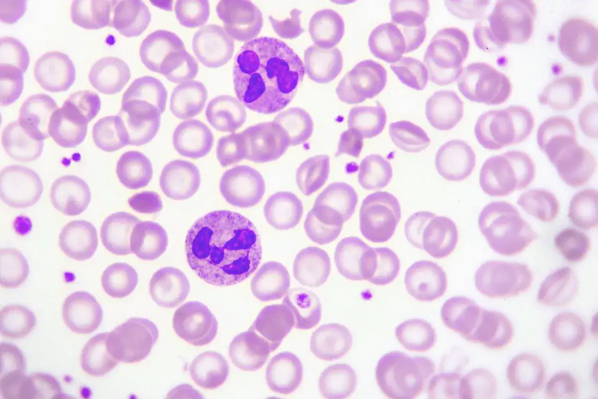 Obraz mikroskopowy krwi: czerwone krwinki i dwa neutrofile. Niska liczba neutrofili to neutropenia, co to jest?