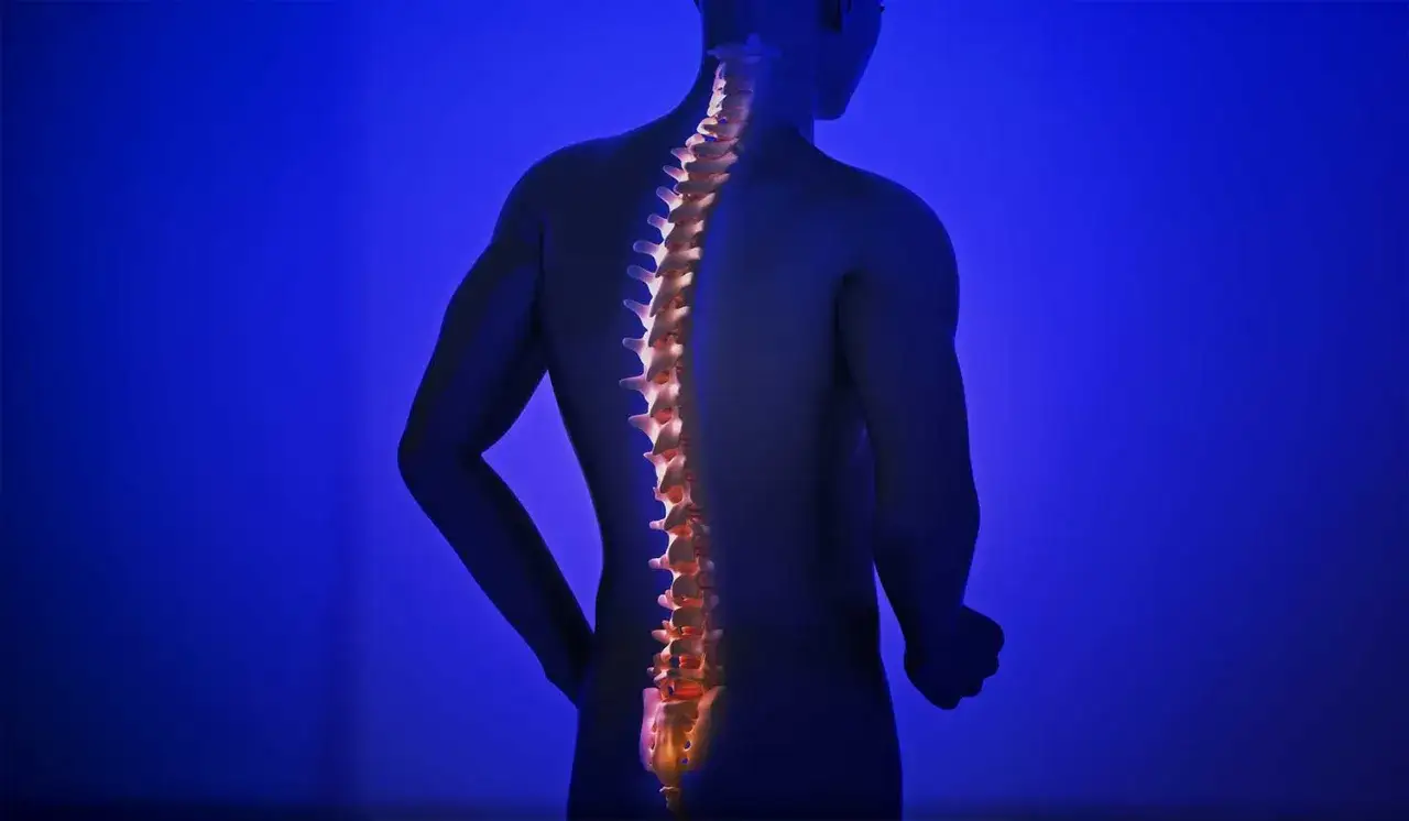Menschliche Wirbelsäule mit Skoliose, beleuchtet, um die Krümmung hervorzuheben. Osteopathie kann bei Skoliose helfen, die Haltung zu verbessern.