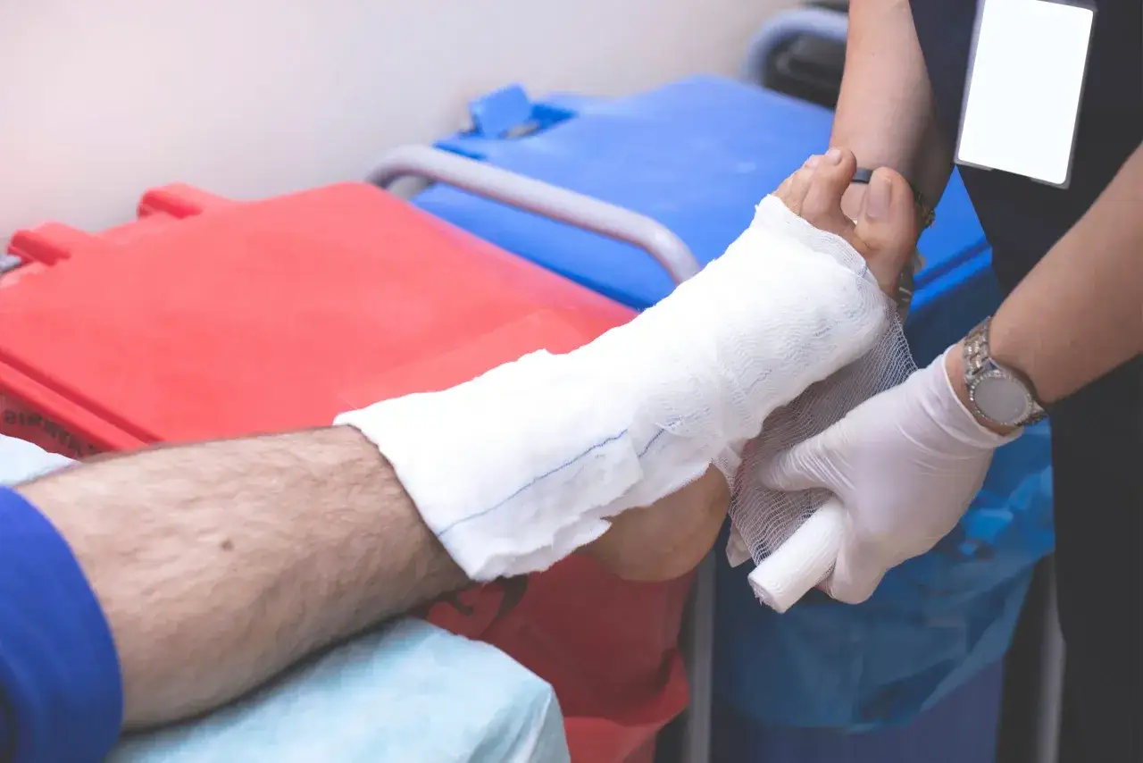 Opatrywanie stopy po oparzeniach chemicznych skóry czym smarować. Ręka w rękawiczce owija bandażem stopę.
