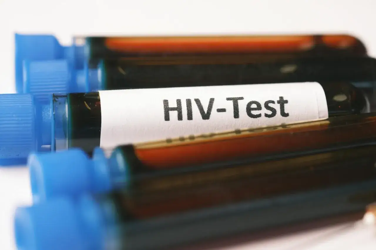 Probówki z próbkami krwi do testu HIV. Wczesne wykrycie objawów u mężczyzn jest kluczowe.