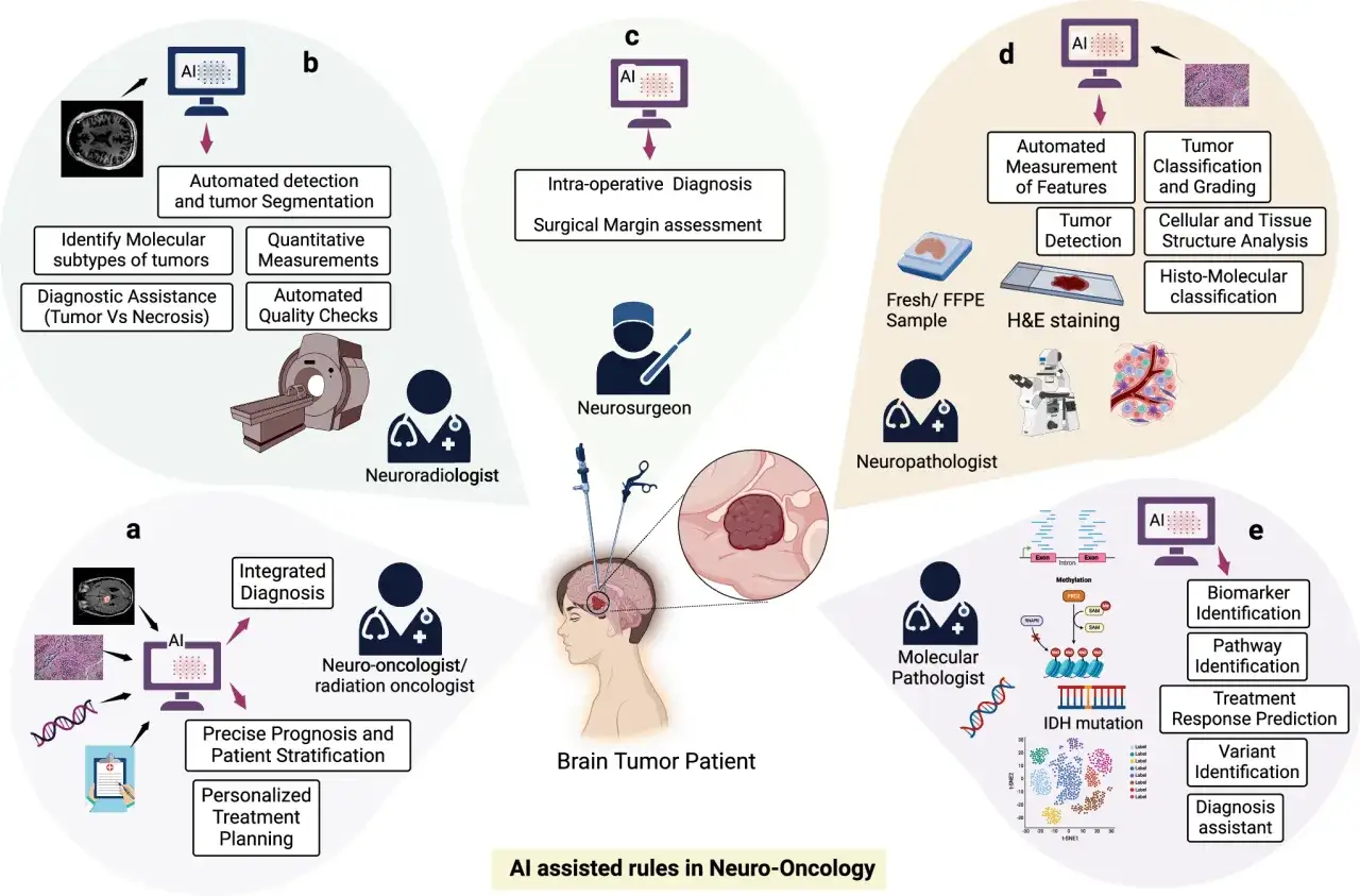AI pomaga w diagnostyce i leczeniu pacjentów z guzem mózgu, wspierając neurochirurgów, radiologów, patologów i onkologów.