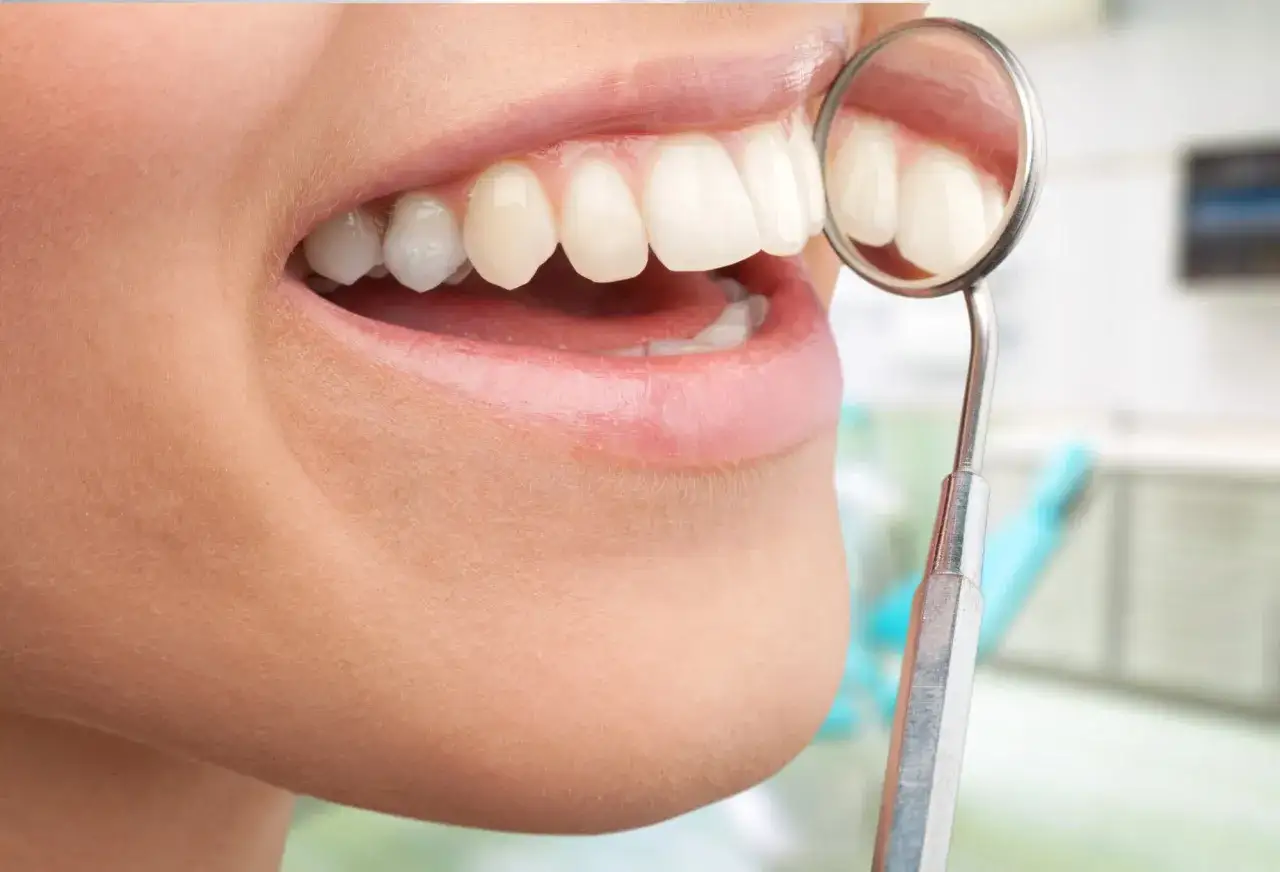 Uśmiech z idealnie białymi zębami, odbijającymi się w lusterku dentystycznym. To dowód na skuteczne i bezpieczne wybielanie zębów.