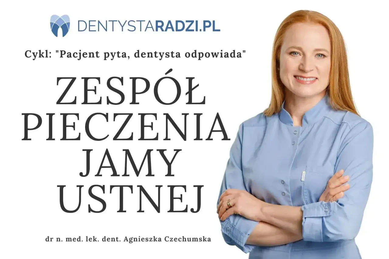 Dr Agnieszka Czechumska omawia zespół pieczenia jamy ustnej.