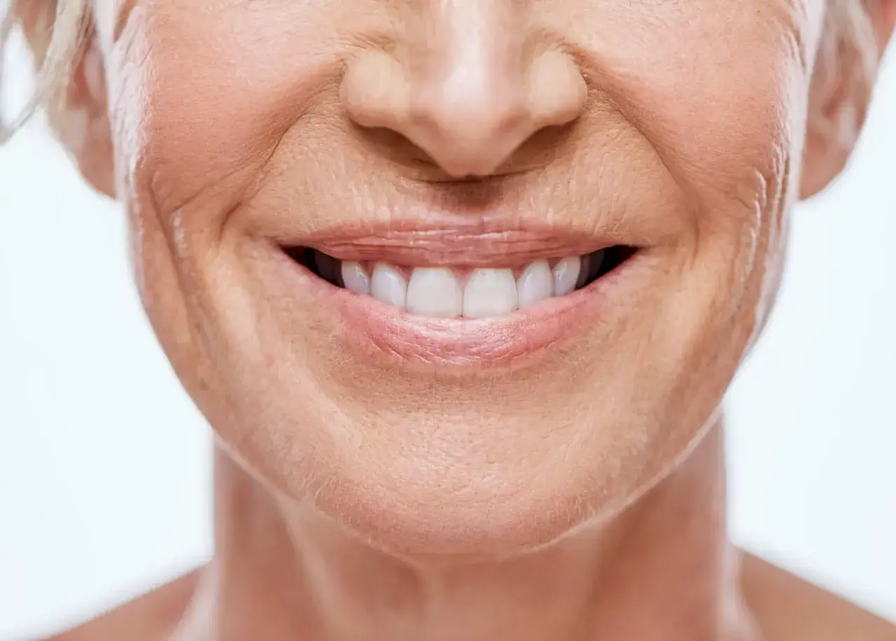 Sonrisa radiante con surco nasogeniano marcado y piel madura.