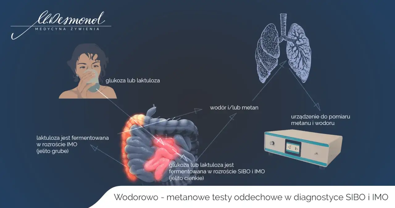 Ilustracja przedstawia test oddechowy do diagnozowania SIBO i IMO. Po spożyciu glukozy lub laktulozy, wod&oacute;r i metan są mierzone w wydychanym powietrzu, co pomaga wykryć tę chorobę.