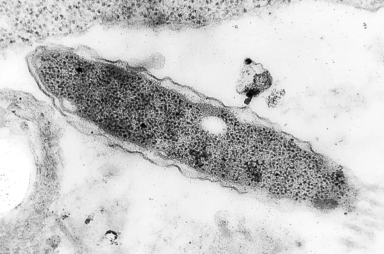 bakterie Legionella mikroskop