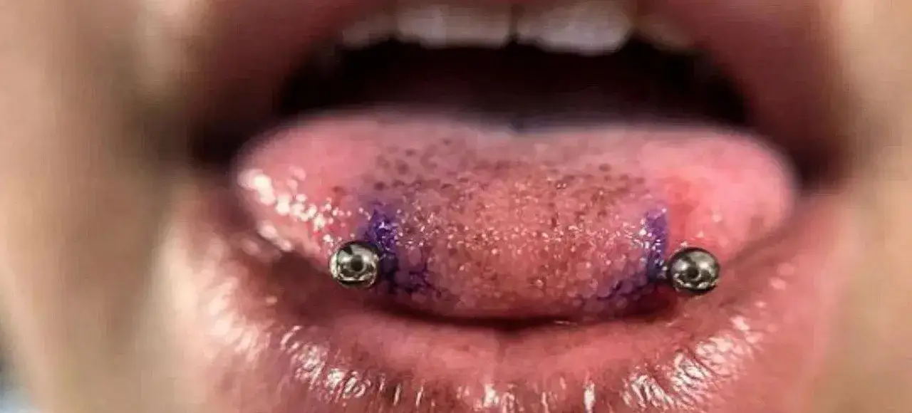 Język z dwoma kolczykami, przypominającymi snake eye piercing. Fioletowy marker podkreśla miejsce przekłucia.
