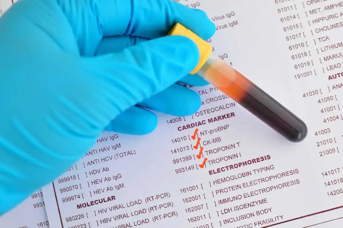 Guanto blu tiene provetta con sangue su referto medico. Valori di proteina c reattiva bassa.