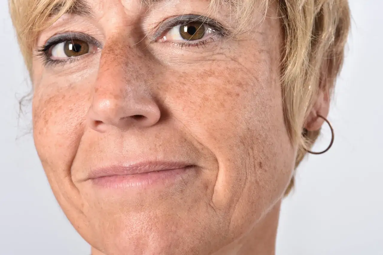 Gros plan sur le visage d'une femme aux cheveux blonds, avec des taches de vieillesse et des rides d'expression.