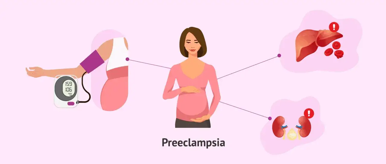 Mujer embarazada de 39 semanas con tensi&oacute;n alta. La imagen muestra un tensi&oacute;metro, h&iacute;gado y ri&ntilde;ones afectados por la preeclampsia.