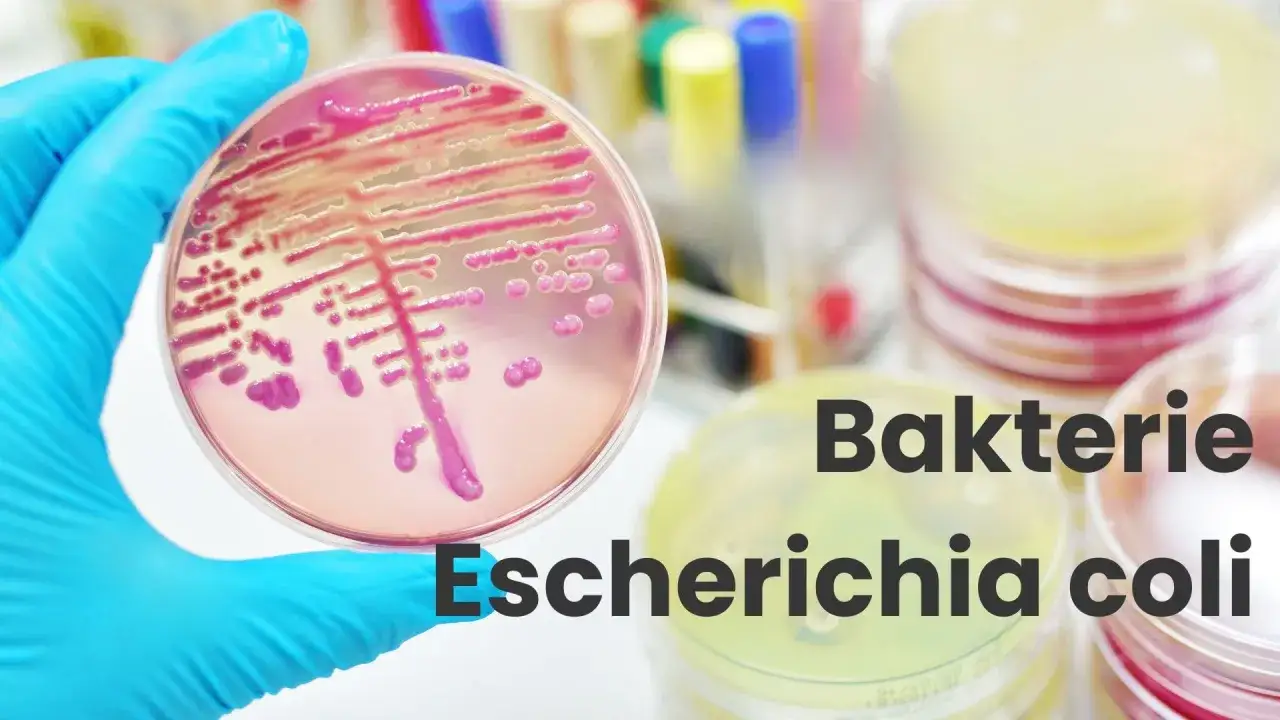 Ręka w niebieskiej rękawiczce trzyma szalkę Petriego z różowymi koloniami bakterii Escherichia coli.