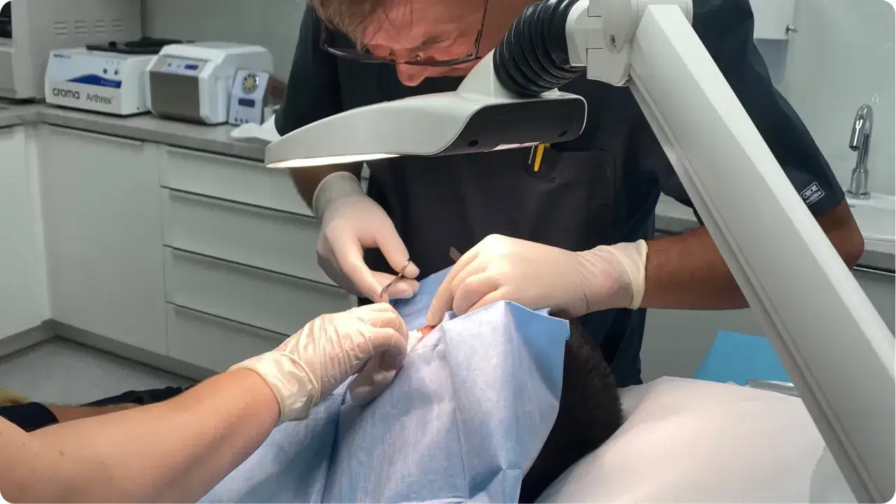 Lekarz podczas zabiegu dermatochirurgii, używając precyzyjnych narzędzi pod powiększeniem.