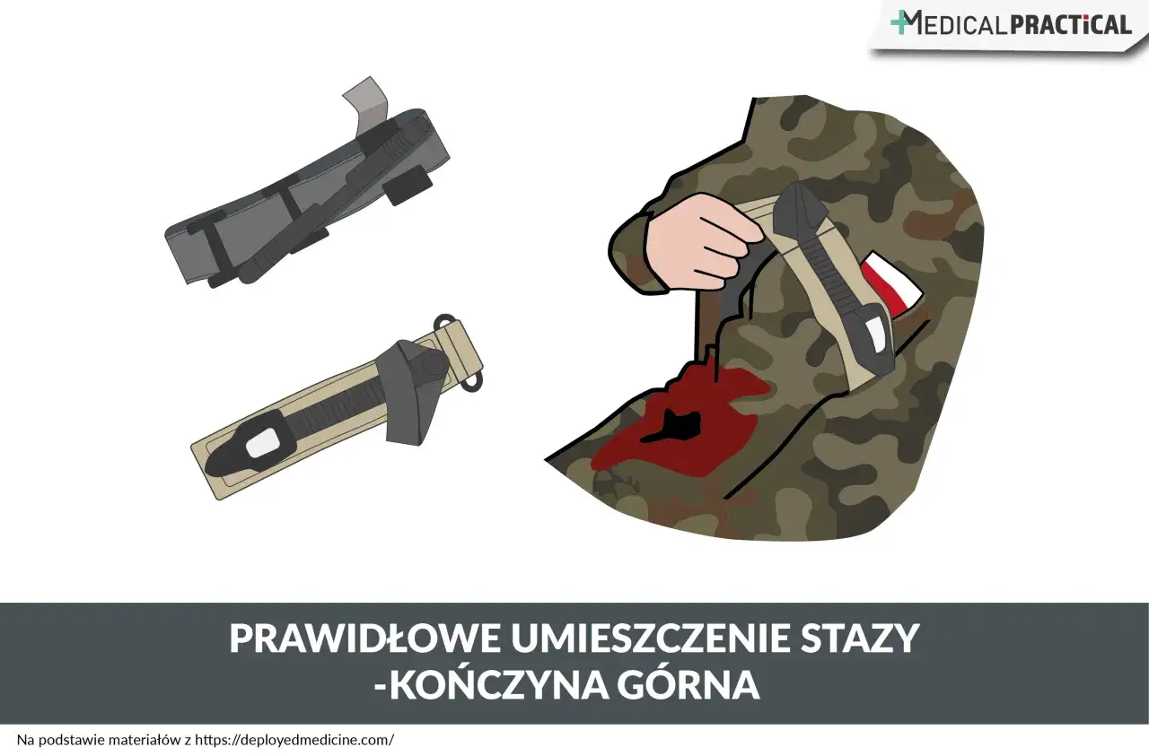 Ilustracja pokazuje, kiedy stosować opaskę uciskową na kończynę górną żołnierza z raną.