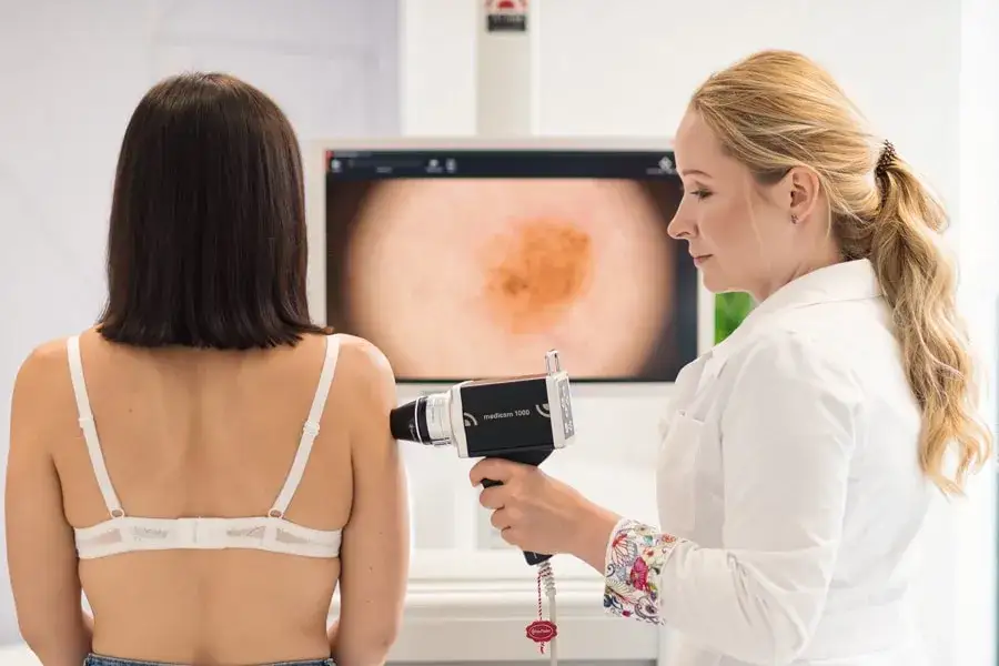 Dermatoskopia badanie znamion