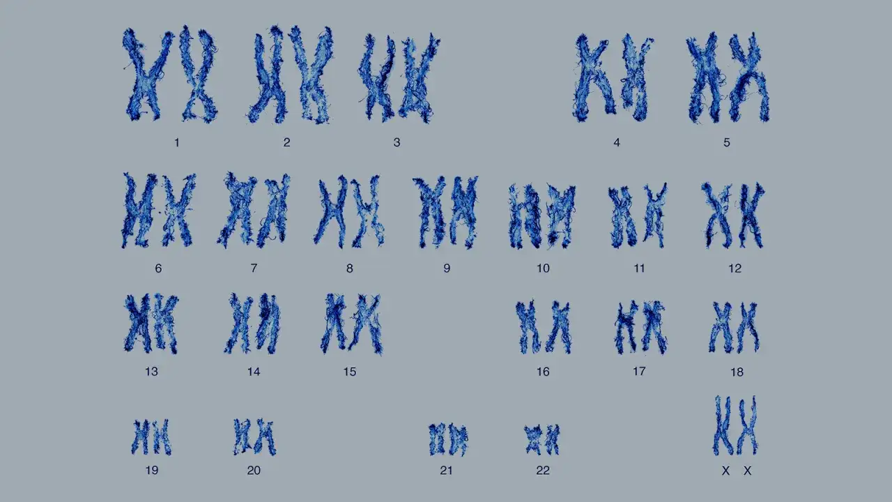 Kariotyp człowieka: 23 pary chromosomów, w tym 22 pary autosomów i 1 para chromosomów płci (XX lub XY).