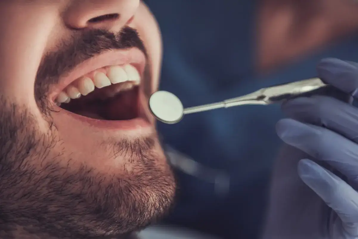 Pacjent z b&oacute;lem zęba w Koninie u dentysty. Badanie jamy ustnej lusterkiem stomatologicznym.