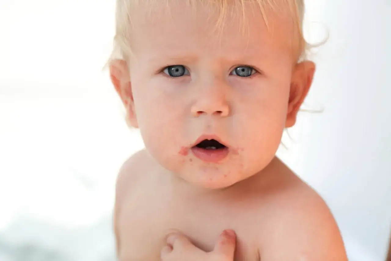 Visage d'un b&eacute;b&eacute; aux yeux bleus, pr&eacute;sentant des rougeurs autour de la bouche, possiblement un eczema bouche b&eacute;b&eacute;.