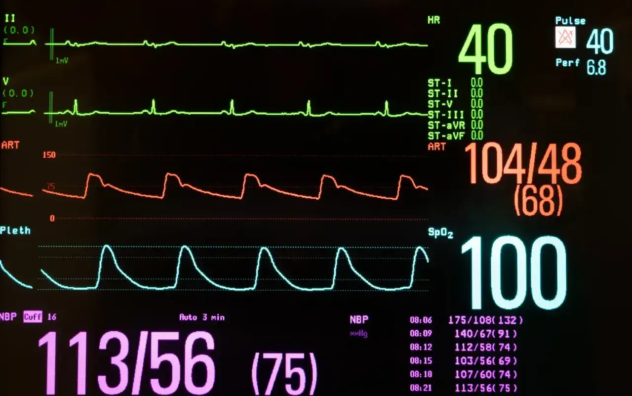 Monitor medyczny pokazuje niskie tętno 40, ciśnienie 104/48 i saturację 100.