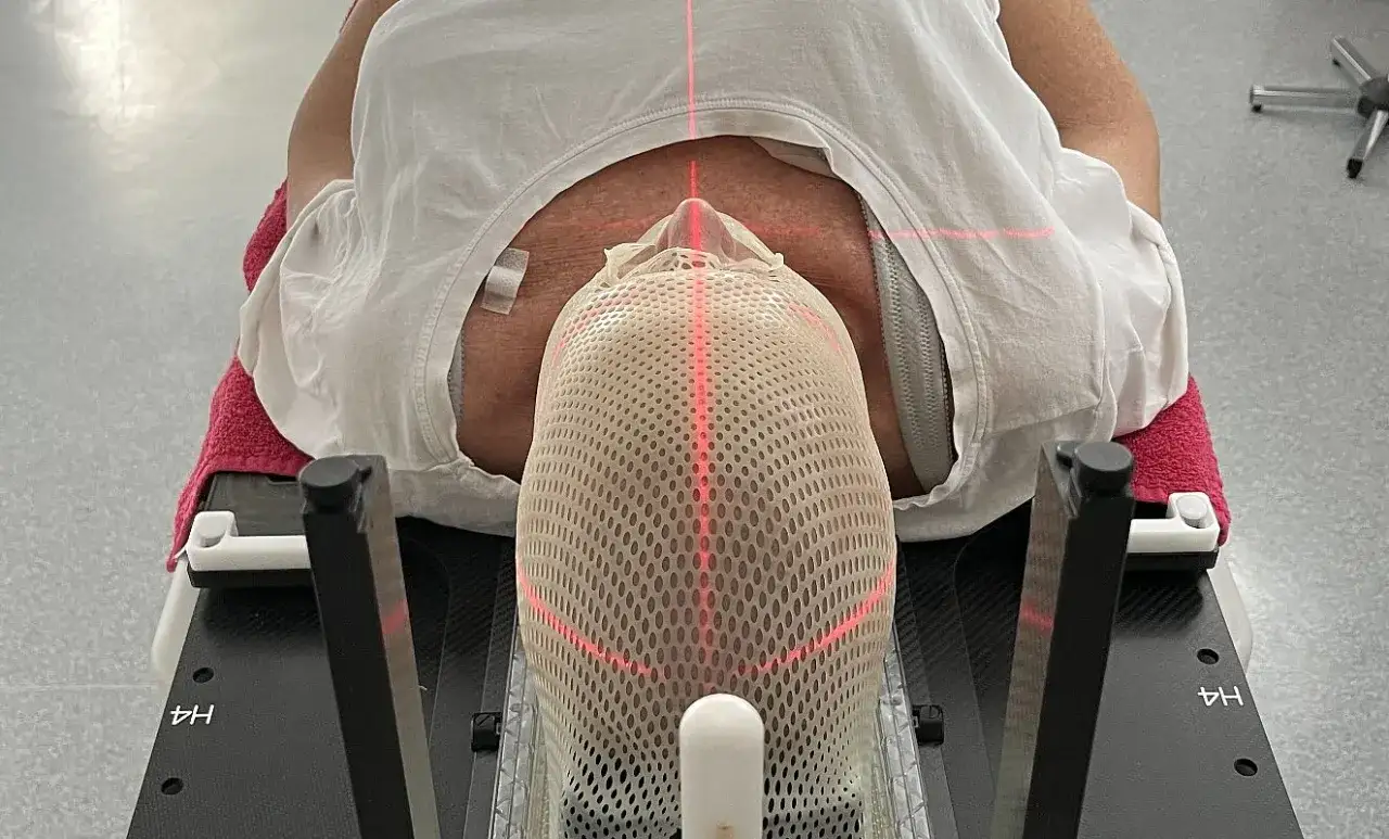 Person liegt auf Liege, Kopf fixiert mit Maske, rote Laserlinien für präzise **Strahlentherapie Brustkrebs Erfahrungen**.