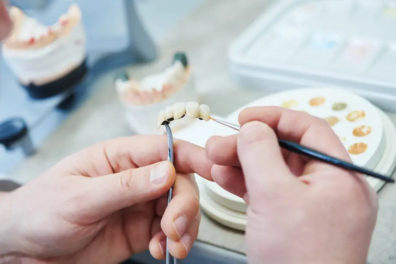 Precyzyjnie kto robi protezy zębowe: technik dentystyczny maluje porcelanowe zęby na modelu.