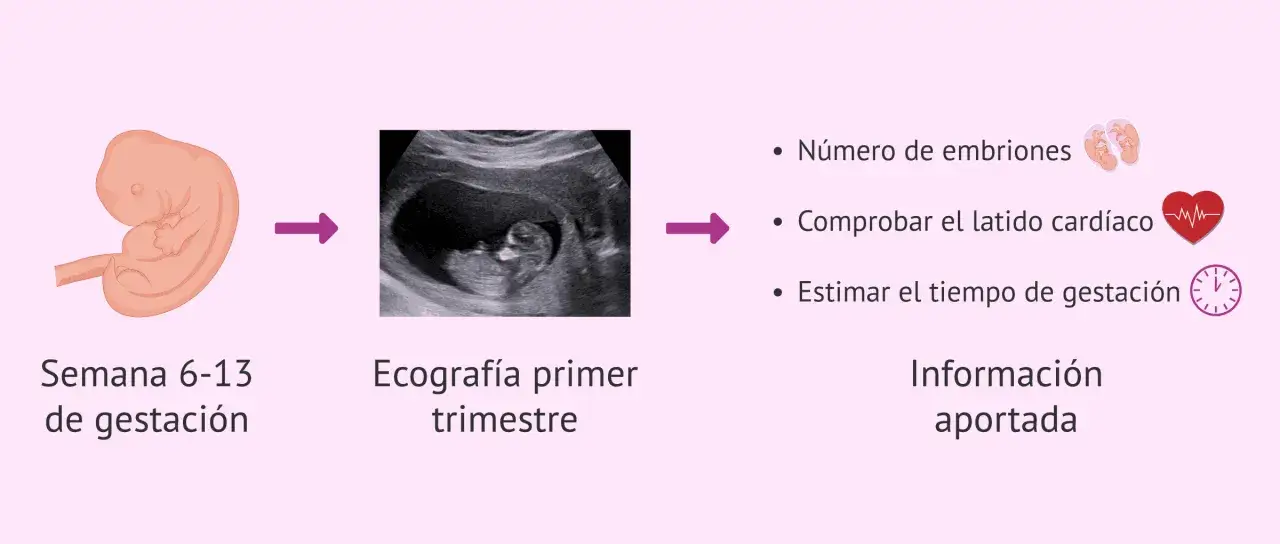 Embarazo a los 40: ecograf&iacute;a del primer trimestre muestra embri&oacute;n, latido y tiempo de gestaci&oacute;n.