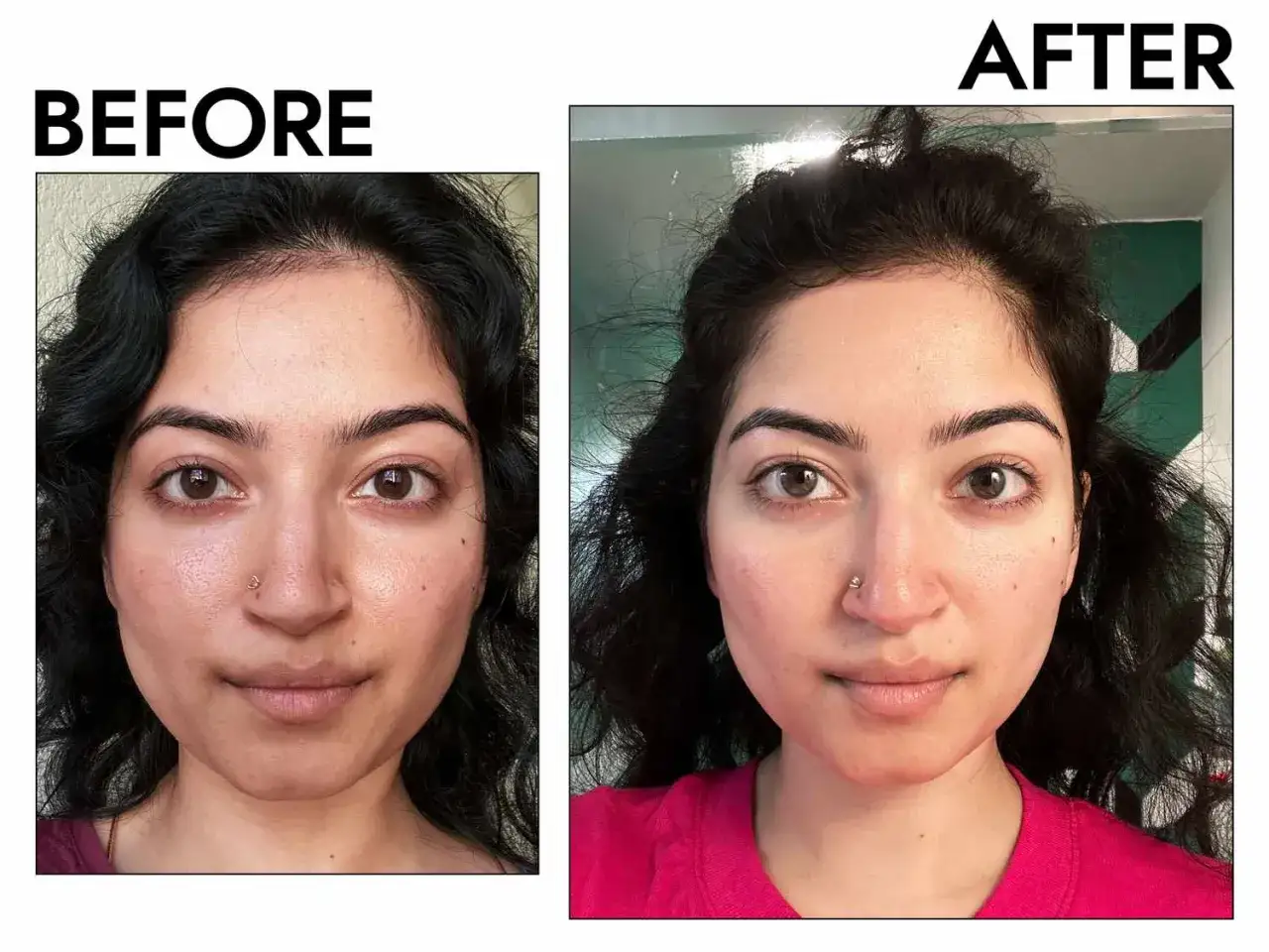 Antes y despu&eacute;s: la piel luce m&aacute;s luminosa y las ojeras hinchadas se han reducido.