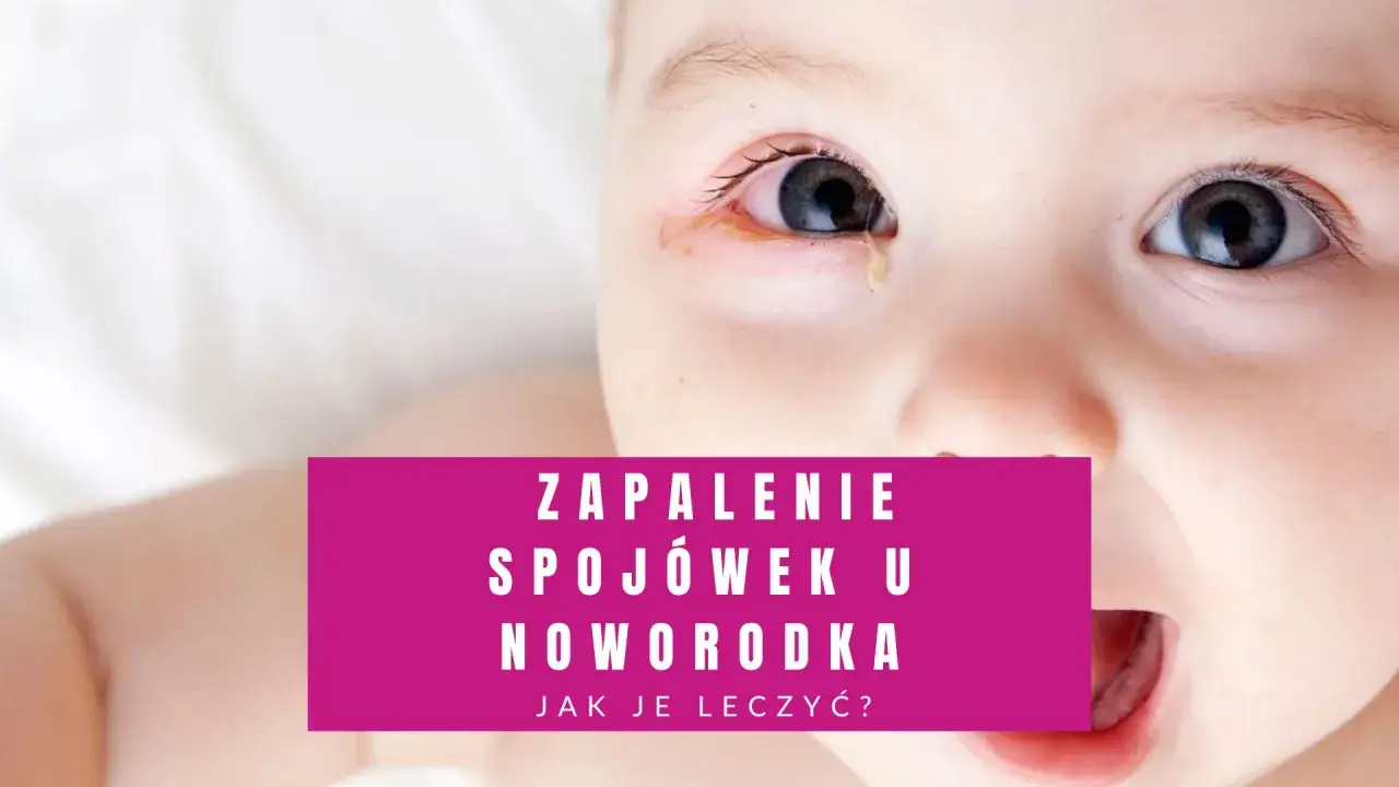 Zbliżenie na twarz noworodka z widocznym zaczerwienieniem i wydzieliną w kąciku oka, sugerujące zapalenie spojówek.