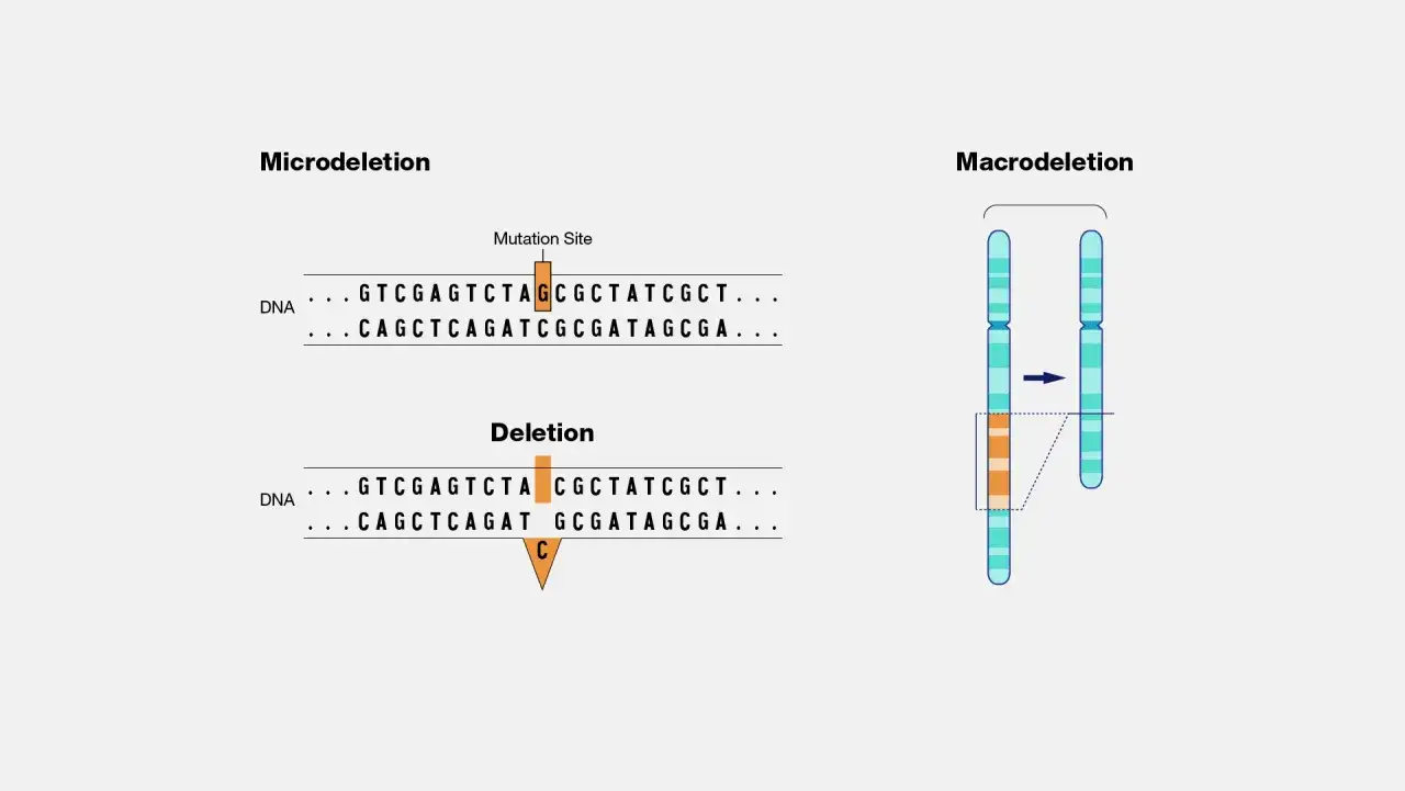 Microdelezioni e macrodelezioni: il significato di delezione nel DNA e nei cromosomi.