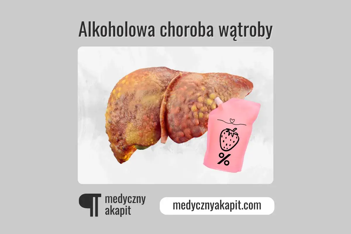 Chora wątroba obok różowego woreczka z truskawką i znakiem procentu. Może to symbolizować nagły spadek tolerancji na alkohol.