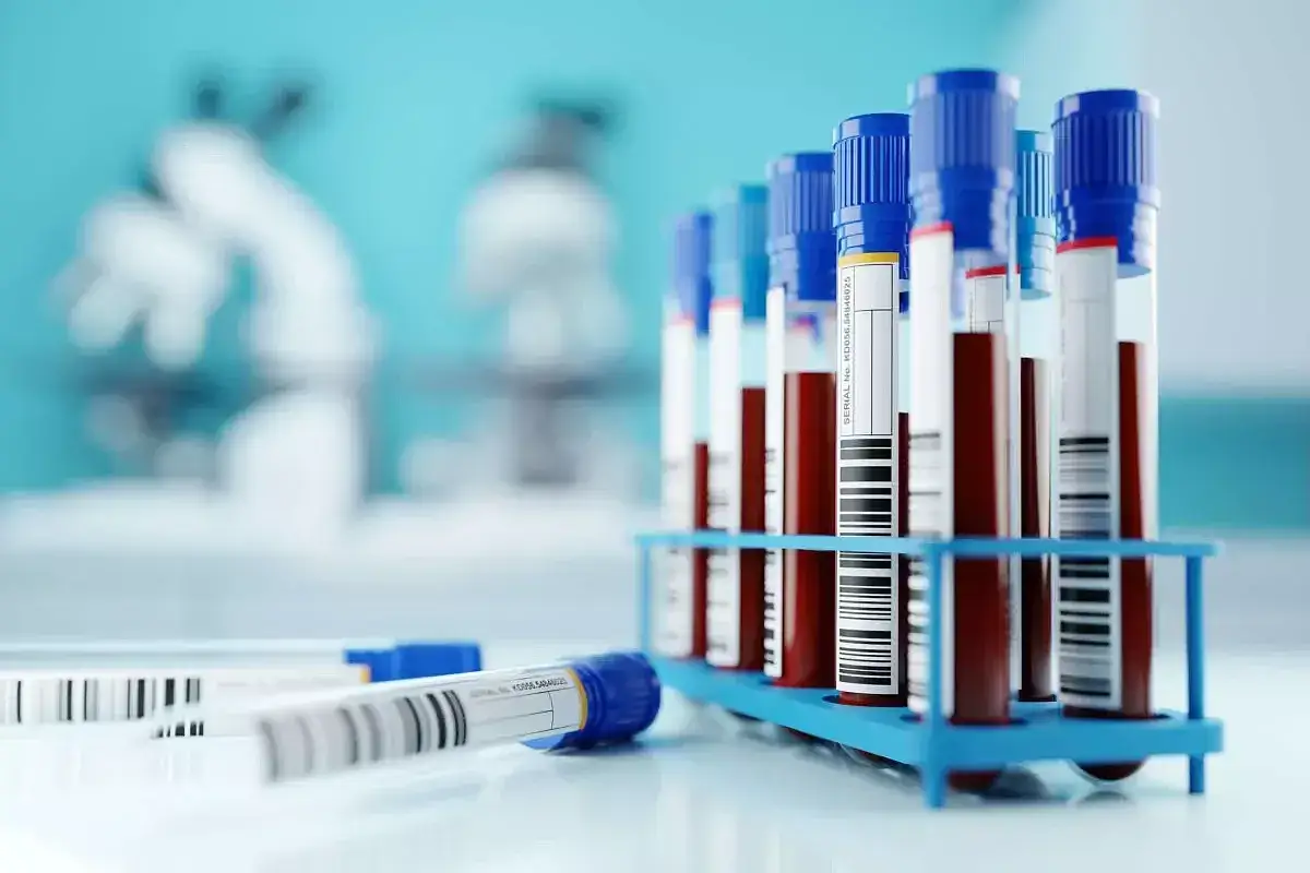 Wysokie ob. w probówkach z krwią czekają na analizę w laboratorium. W tle widać mikroskopy.