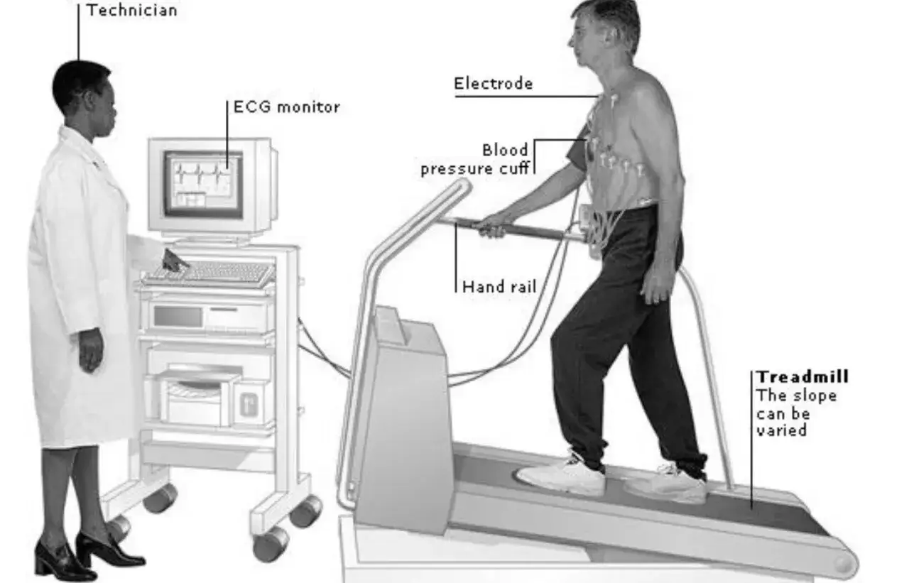 Un homme subit un test d'effort dangereux sur un tapis roulant, surveillé par une technicienne et un moniteur ECG.