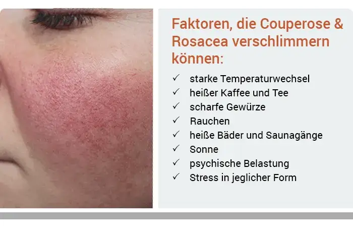 Inhaltsstoffe meiden Couperose