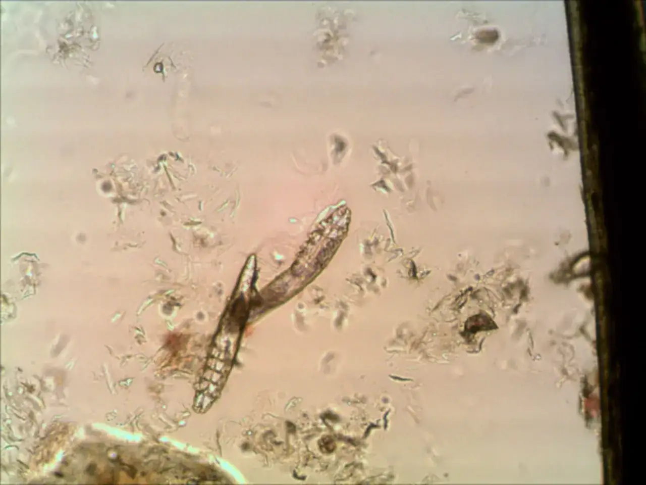 Mikroskopische Aufnahme von Demodex Milben, die oft bei Hunden vorkommen. Diese winzigen Parasiten leben in den Haarfollikeln.