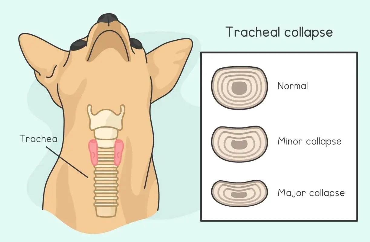 Ilustración muestra la anatomía de la tráquea de un perro y los grados de colapso traqueal en perros: normal, leve y severo.