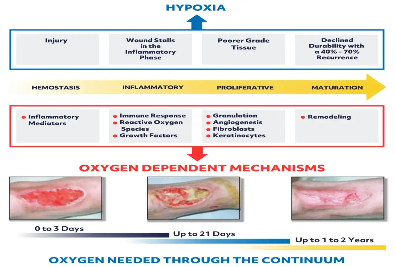 Sch&eacute;ma montrant l'impact de l'hypoxie sur la cicatrisation des plaies, de l'inflammation &agrave; la maturation. Une bonne oxyg&eacute;nation est cl&eacute; pour une cicatrisation rapide.