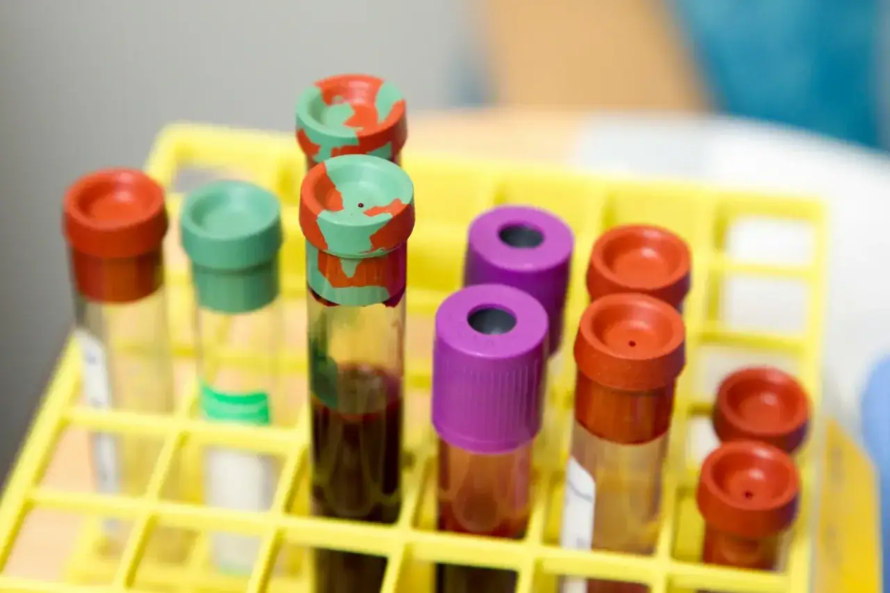 Probówki z krwią w żółtym stojaku. To próbki do badań, np. hct morfologia co to jest.