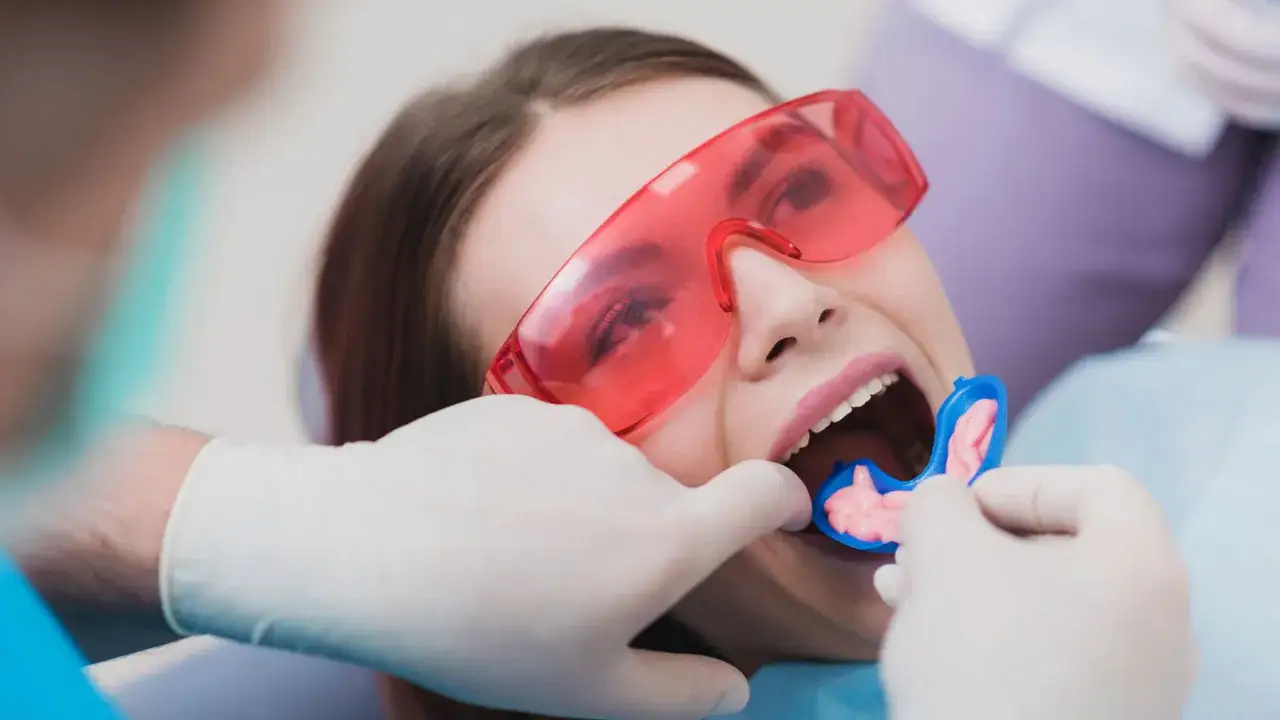 Pacjentka w okularach ochronnych przechodzi zabieg fluoryzacji. Dentysta zakłada jej do ust specjalną nakładkę z żelem.