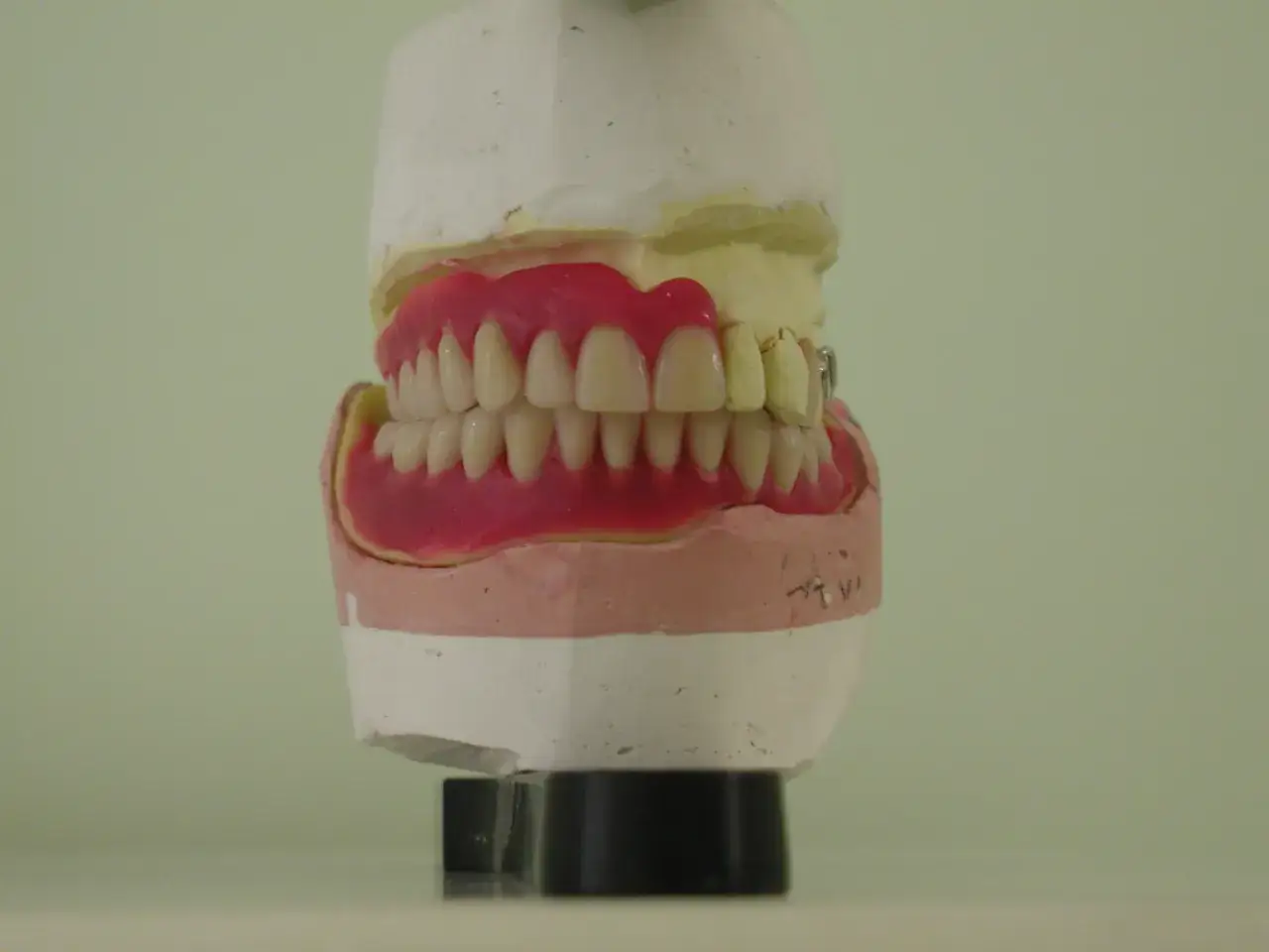 Modello di protesi mobile inferiore, con denti finti su gengiva rosa, che illustra potenziali problemi di adattamento.