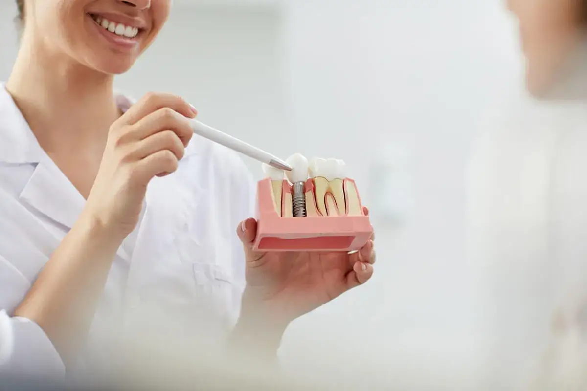 Dentystka pokazuje model szczęki z implantem, omawiając potencjalne ryzyko odrzucenia implantu zęba.