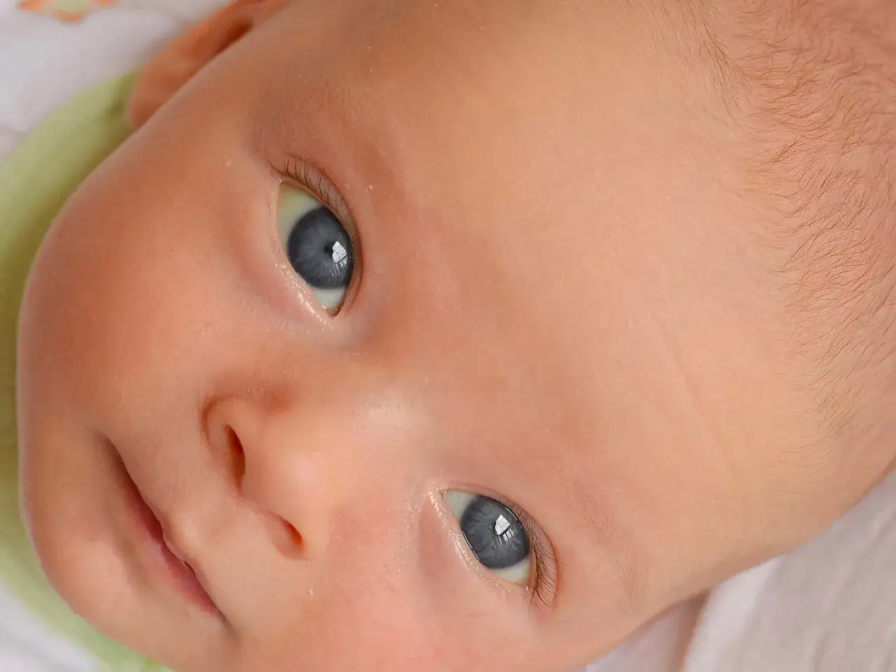 Occhi di neonato con sclere leggermente giallastre, un segno di giallo ittero. La pelle è rosea, i capelli biondi e fini.