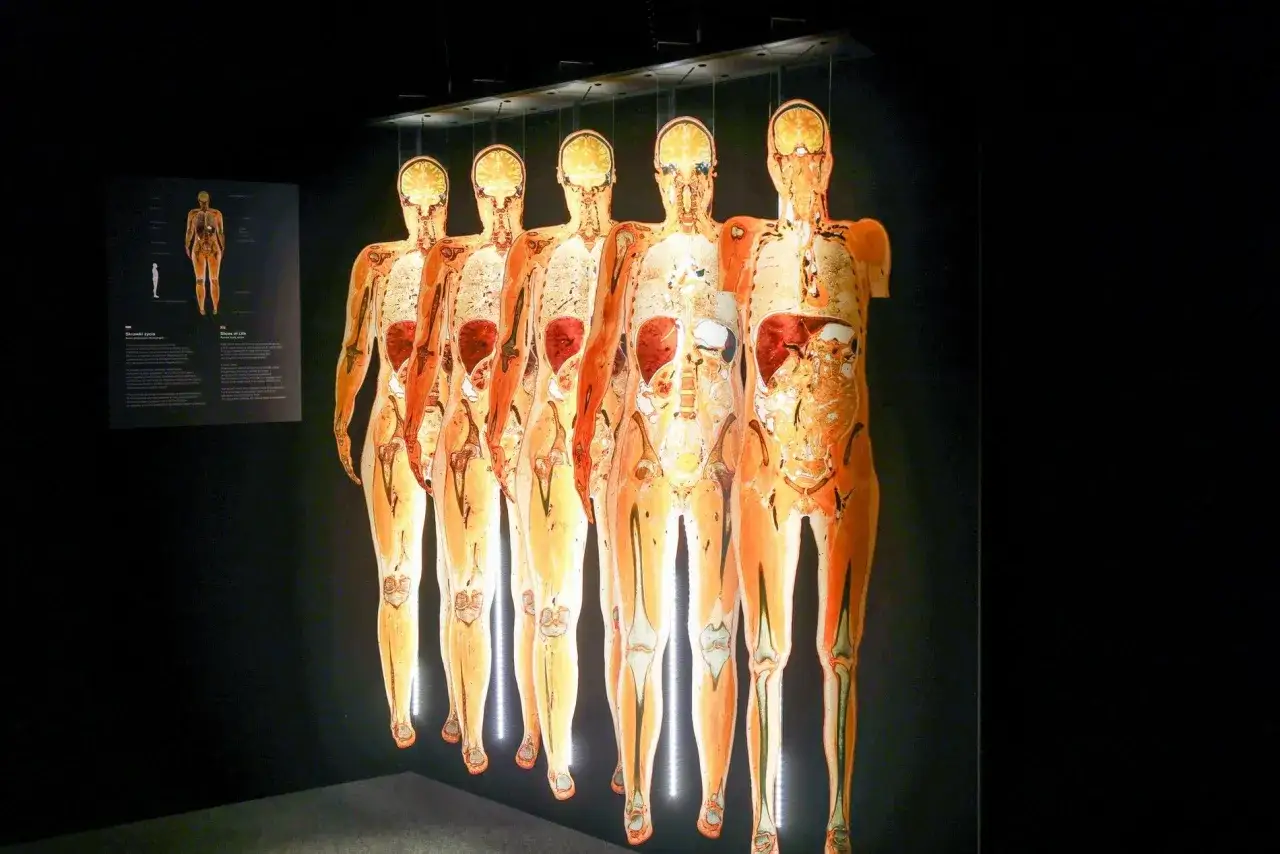 Wystawa Body Worlds Wrocław prezentuje przekroje ludzkich ciał, ukazując ich narządy i kości w niezwykłej perspektywie.