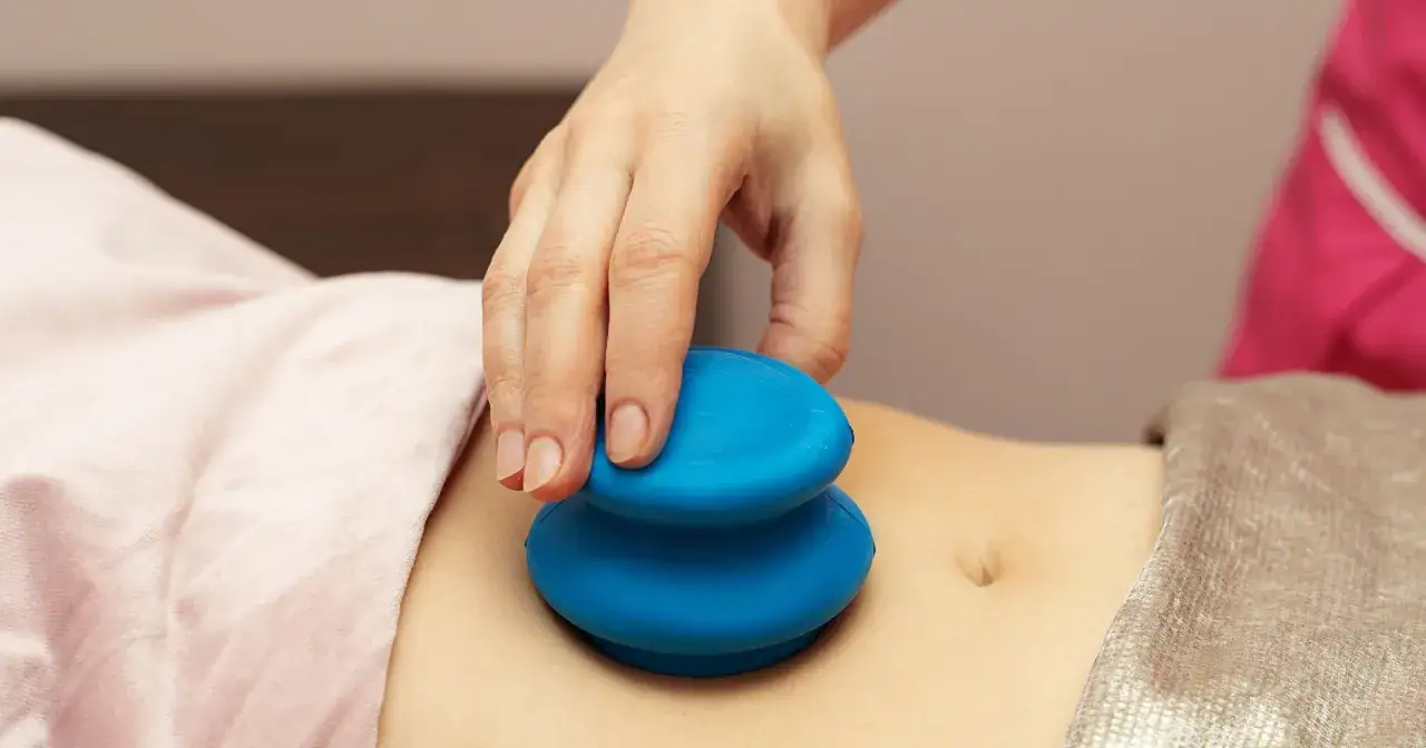Dłoń terapeuty trzyma niebieskie bańki chińskie na brzuchu. Zastanawiasz się nad bańki chińskie efekty po jakim czasie?