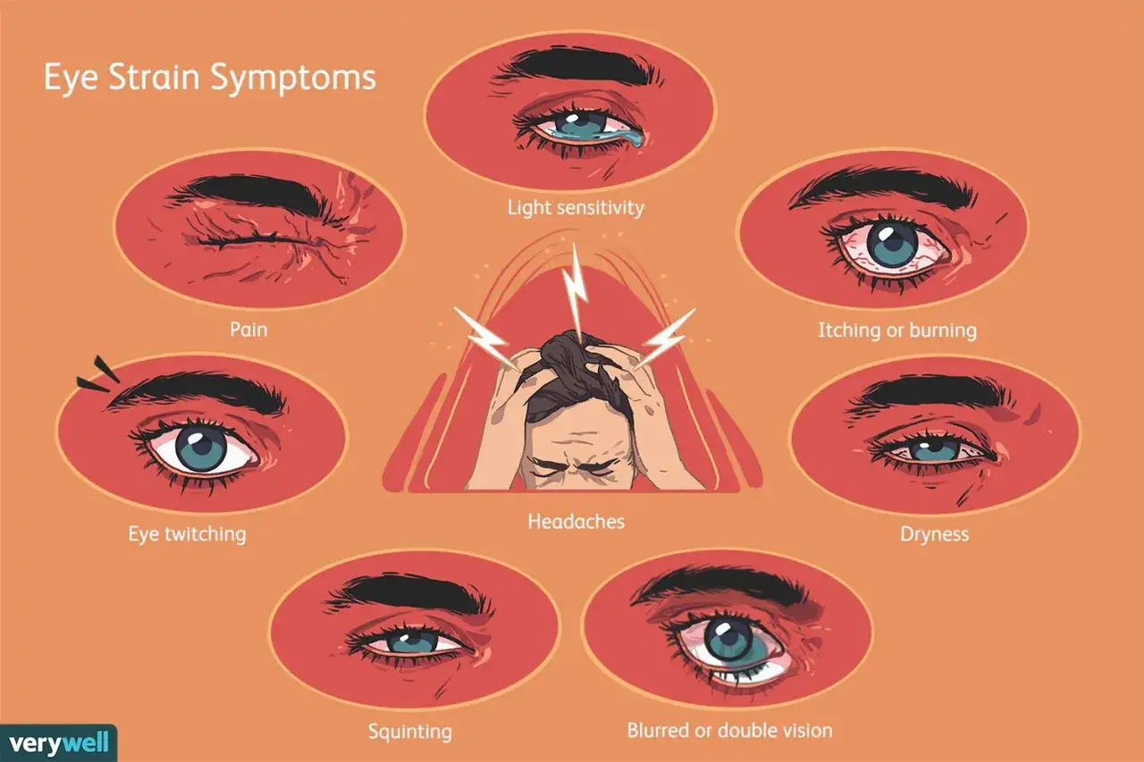 Objawy zmęczenia oczu: ból, światłowstręt, swędzenie, suchość, drganie, zezowanie, niewyraźne widzenie. Zespół zbyt długiego noszenia soczewek może powodować te dolegliwości.