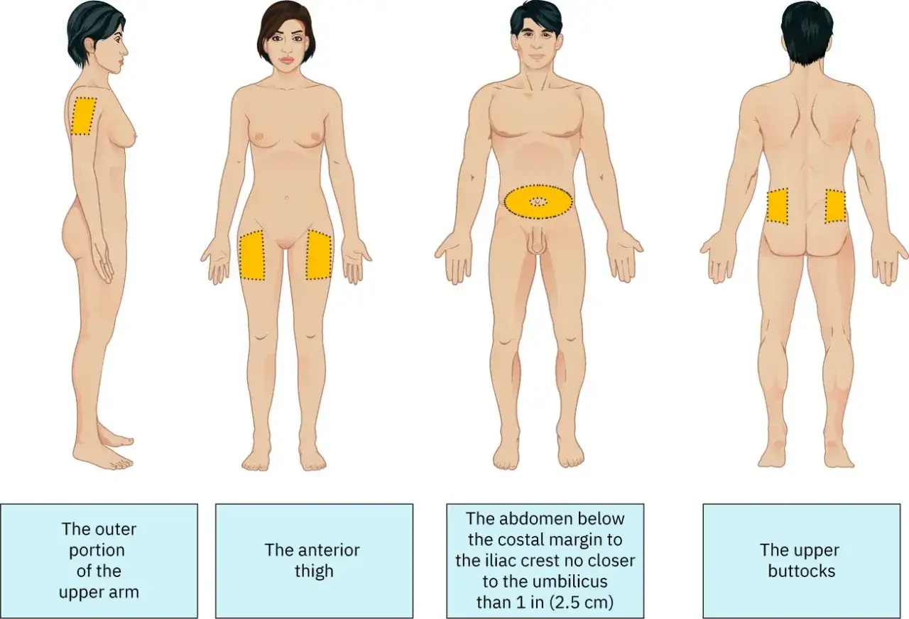 Illustrationen zeigen Körperstellen für Injektionen: Oberarmaußenseite, Oberschenkelvorderseite, Bauch (unterhalb Rippenbogen, oberhalb Beckenkamm, Abstand Nabel beachten) und oberes Gesäß. Hier kann man weit spritzen.