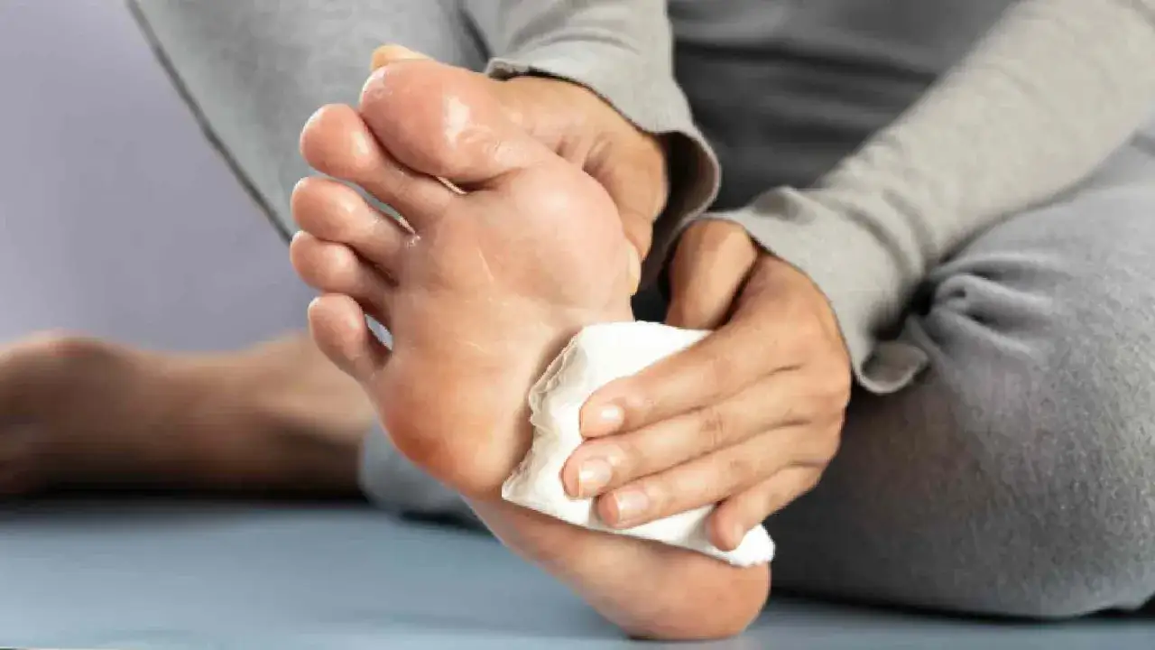 Piedi che soffrono di sudorazione eccessiva, una persona asciuga la pianta del piede con un fazzoletto.