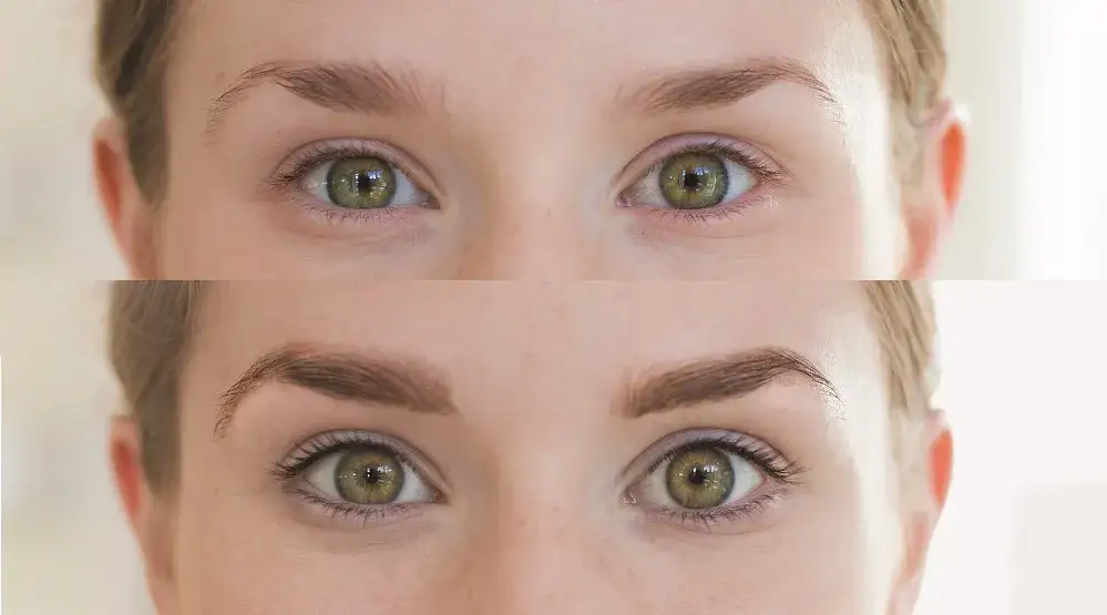 refectocil sensitive before after