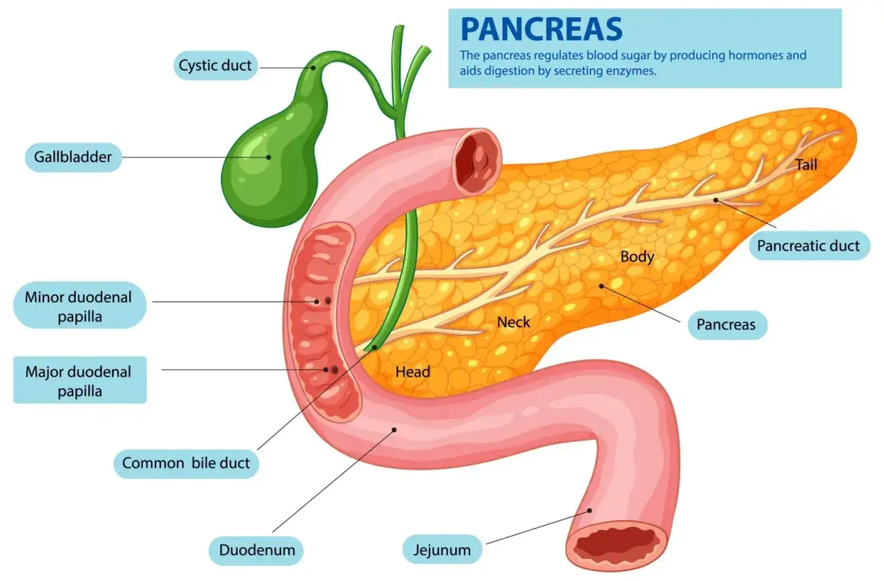 Anatomia trzustki, pęcherzyka żółciowego i dwunastnicy. Ilustracja pokazuje, jak przewlekłe zapalenie trzustki może wpływać na te narządy.