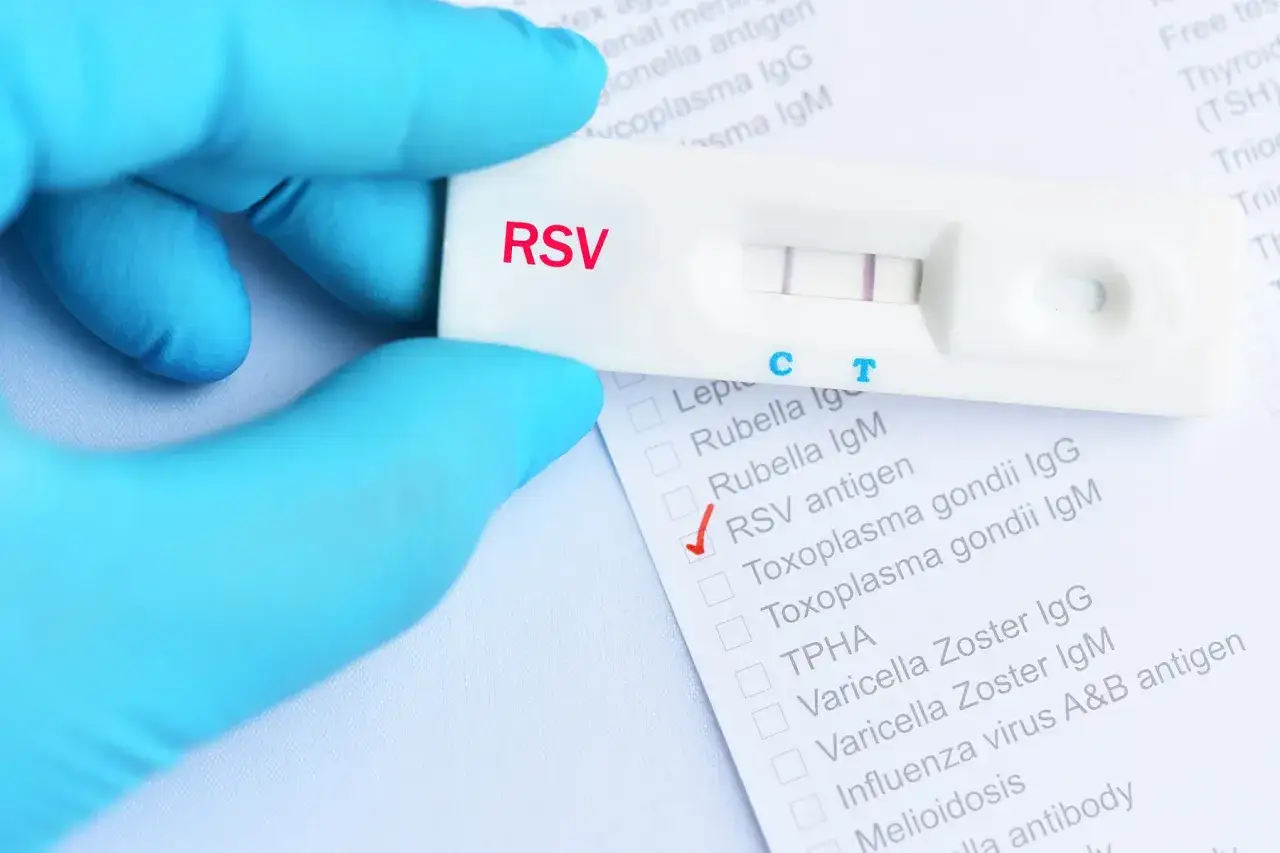 Rękawiczka w niebieskiej rękawiczce trzyma test RSV z dwoma paskami. Obok znajduje się lista badań, z zaznaczonym